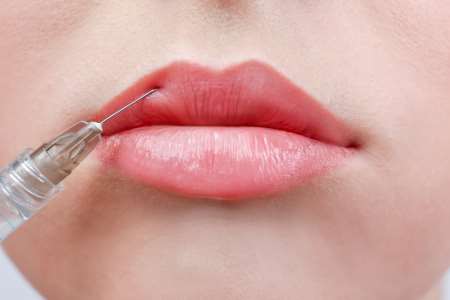 Lip Filler and Injections in Central Florida